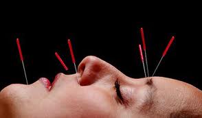 Acupuncture tap meridians